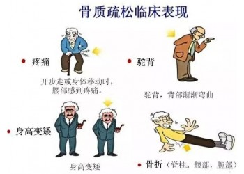 你知道骨质疏松症对你的生活有哪些影响吗?
